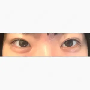 フィラークリニック 大阪心斎橋院口コミ