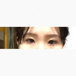共立美容外科 福岡院口コミ