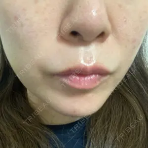 椿クリニック 心斎橋院口コミ