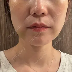 湘南美容クリニック 渋谷院口コミ