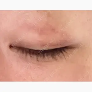 PRISM Beauty Clinic 町田院口コミ