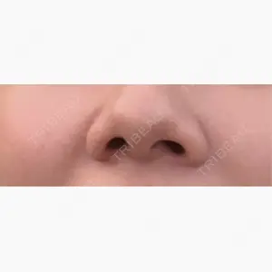 ティアラクリニック 川越院口コミ