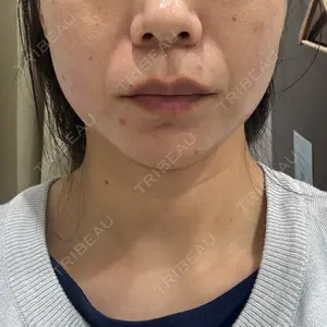 湘南美容クリニック 広島院口コミ