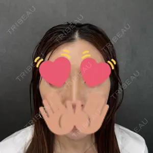 ネビュラクリニック 京都院口コミ