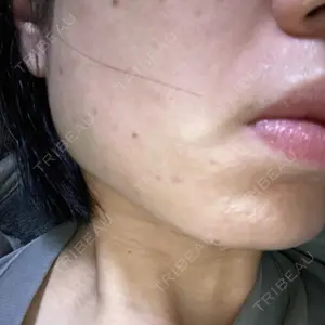 NEO Skin Clinic銀座口コミ