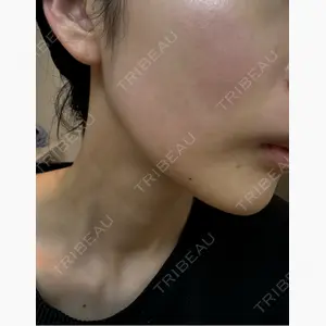 ミニマムスキンクリニック銀座口コミ