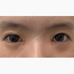 HAAB×DREAM BEAUTY CLINIC 大阪梅田院口コミ