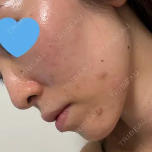 千葉美容外科アイビークリニック口コミ