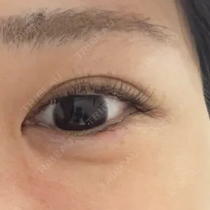 新未来クリニック口コミ