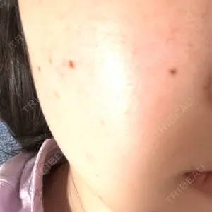 ルラ美容クリニック 渋谷本院口コミ