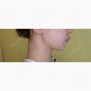 DMTC CLINIC 渋谷院口コミ