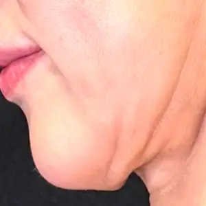 Ledian Clinic六本木口コミ