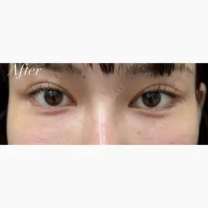 AI Beauty Clinic （エーアイ美容クリニック）口コミ