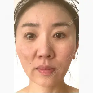札幌美容外科ネビュラクリニック口コミ