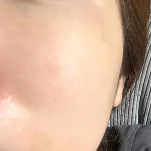ルラ美容クリニック 札幌本院口コミ
