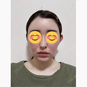 R Beauty CLINIC 銀座院口コミ