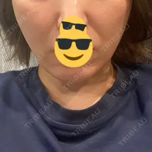 ルラ美容クリニック 広島院口コミ