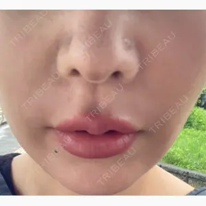博多美容外科/美容皮膚科 ビラビューティークリニック口コミ