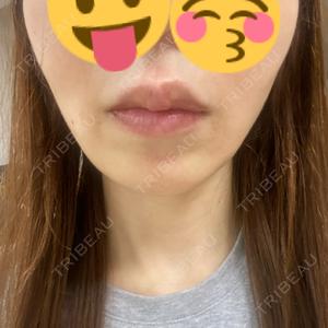 BELINDA CLINIC（ベリンダクリニック）岡山院口コミ