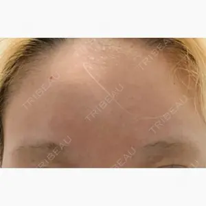 Zetith Beauty Clinic 池袋院口コミ