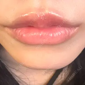 HAAB×DREAM BEAUTY CLINIC 大阪梅田院口コミ