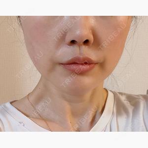 THE CLINIC（ザ・クリニック） 大阪院口コミ