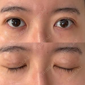 EMMA CLINIC（エマクリニック）口コミ