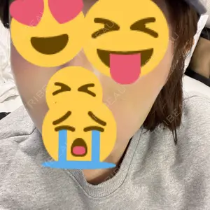 東郷美容形成外科　福岡口コミ
