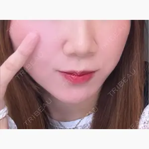 札幌美容外科ネビュラクリニック口コミ