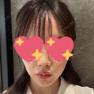 東京美容皮膚科アロエクリニック池袋西口院口コミ