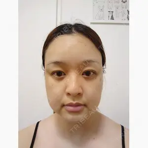 藤・ナチュレ美容クリニック 銀座院口コミ