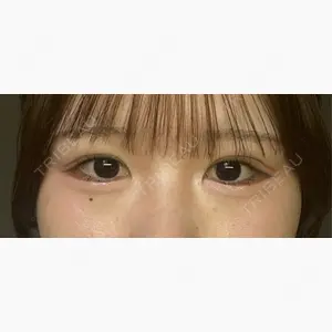 東京シンデレラ美容外科 池袋院口コミ