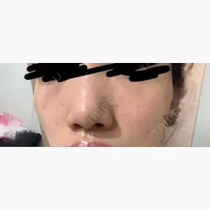 Natural Skin Clinic 自由ヶ丘院口コミ