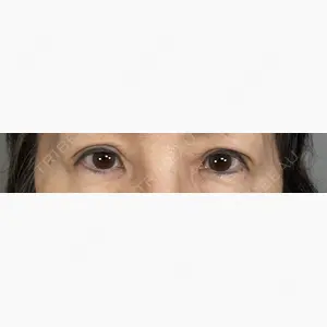 アリエル美容クリニック 大宮院口コミ