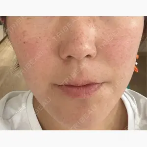 アデル美容クリニック口コミ