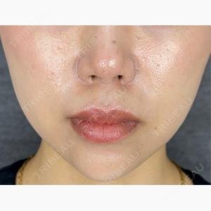 NARU SKIN Beauty Clinic口コミ