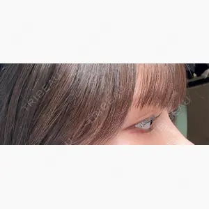 9BeautyClinic口コミ