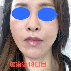 東京シンデレラ美容外科 池袋院口コミ