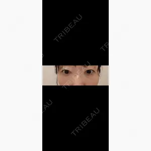 TCB東京中央美容外科 岡山院口コミ