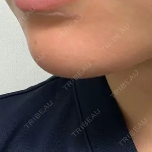 アールクリニック口コミ