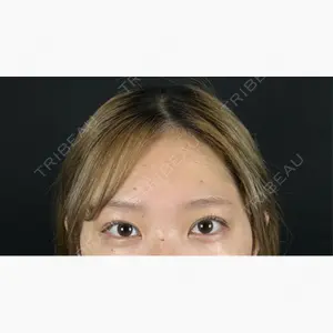 藤・ナチュレ美容クリニック 銀座院口コミ