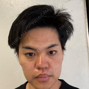 BOSSクリニック上野口コミ