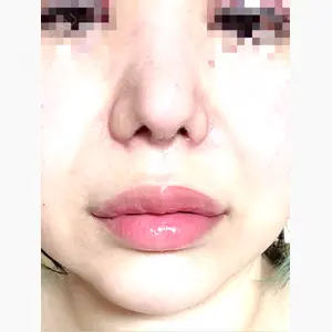 東京シンデレラ美容外科 池袋院口コミ