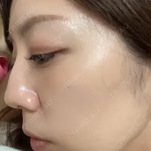 HAAB×DREAM BEAUTY CLINIC 大阪梅田院口コミ