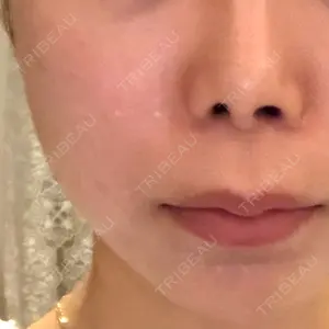 Natural Skin Clinic 自由ヶ丘院口コミ