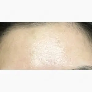 FACE SKIN CLINIC 池袋口コミ