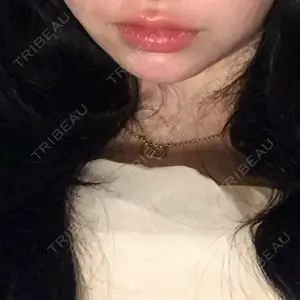 HAAB×DREAM BEAUTY CLINIC 大阪梅田院口コミ