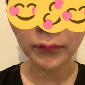 ライブリークリニック 大阪院口コミ
