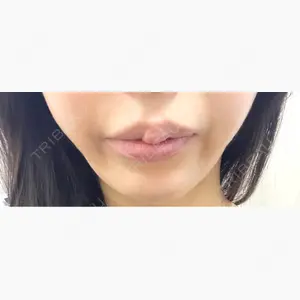 湘南美容クリニック 金山院口コミ