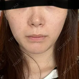 札幌美容外科ネビュラクリニック口コミ